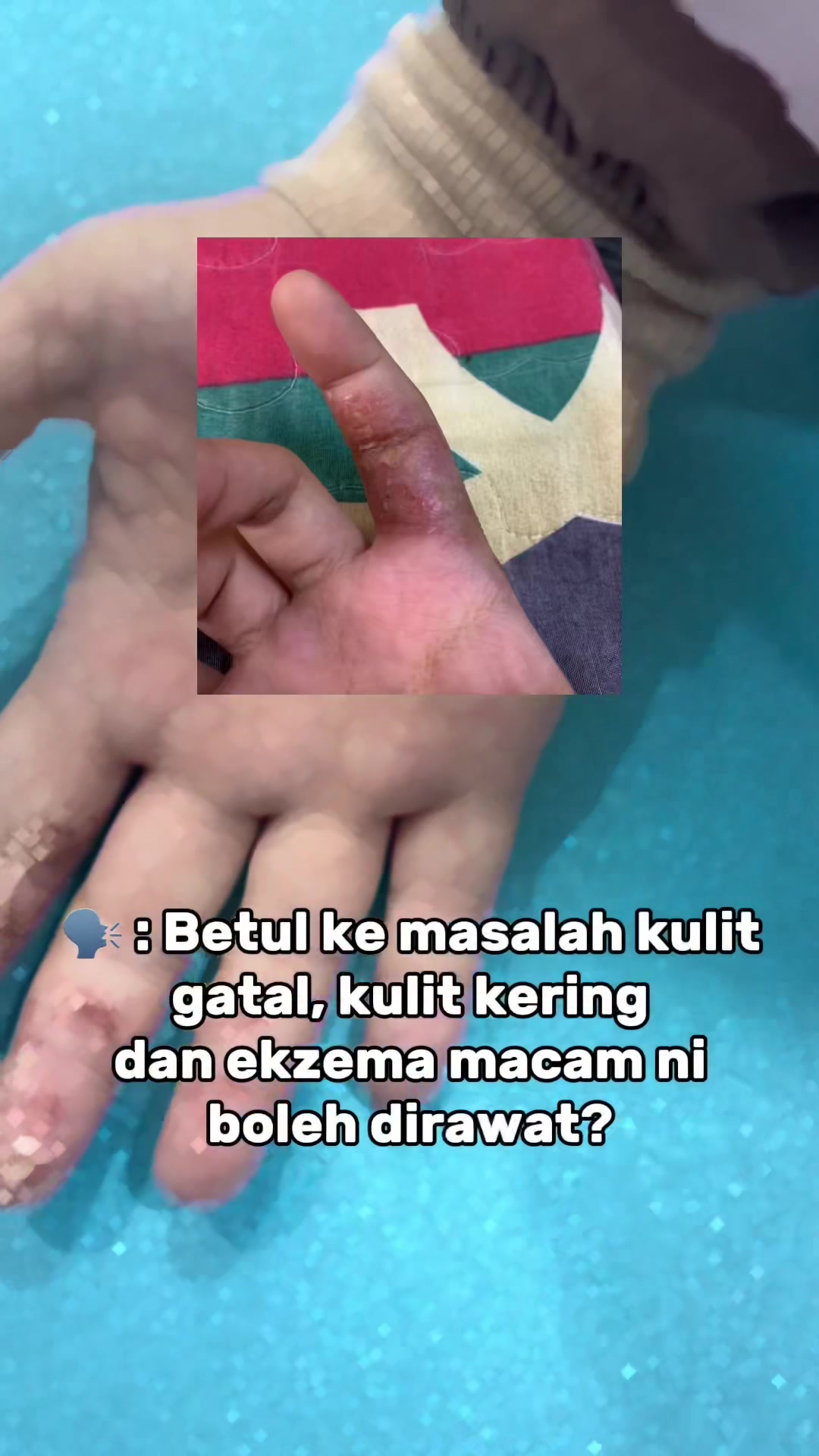 @Dr.Lyna Kulit.Aesthetic.Laser