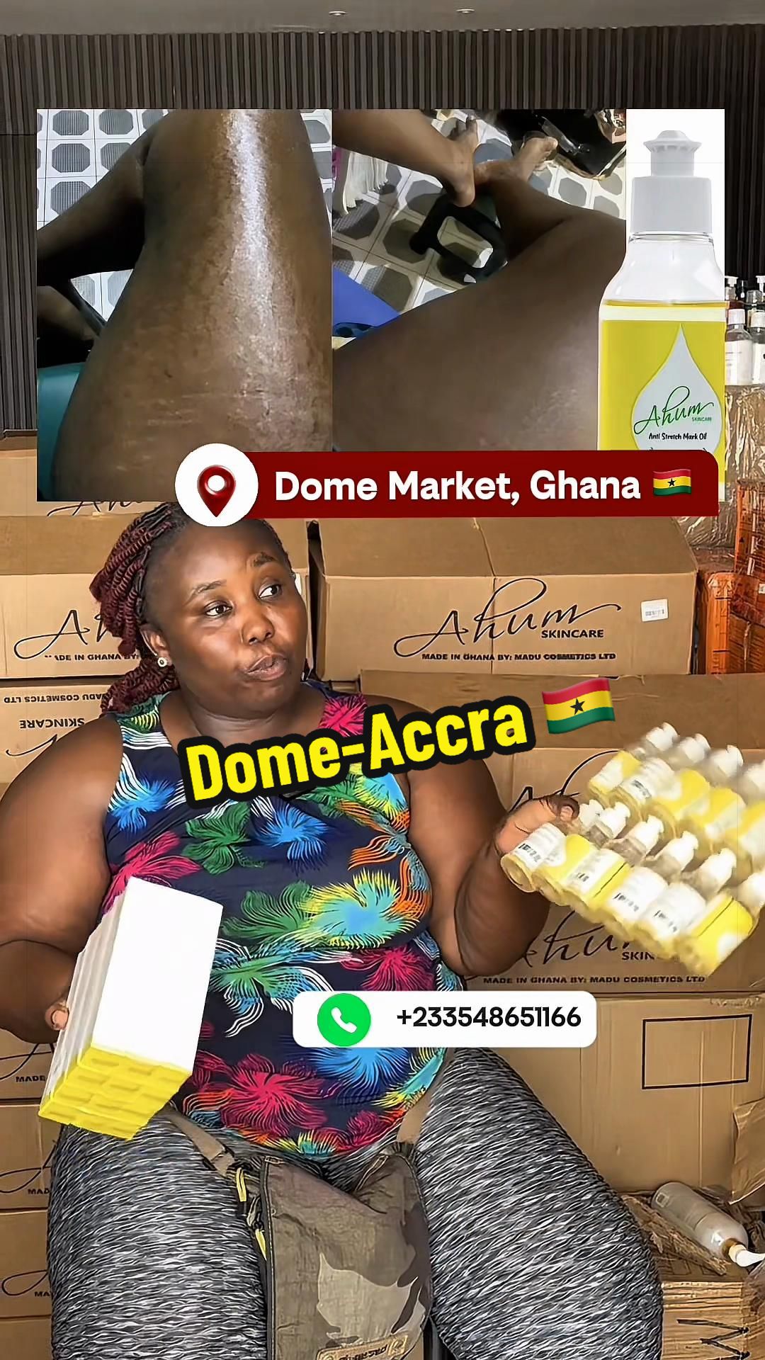 @No1 STRETCH MARKS PRODUCT
