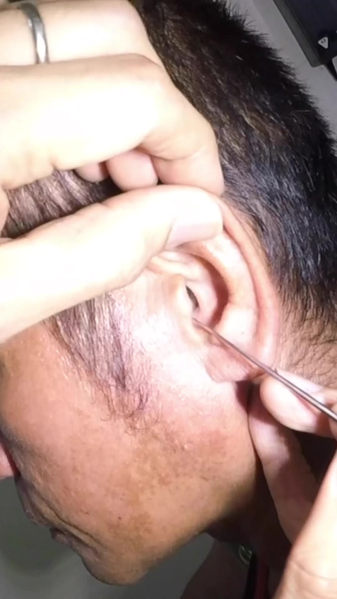 @TheEarwaxSpecialist