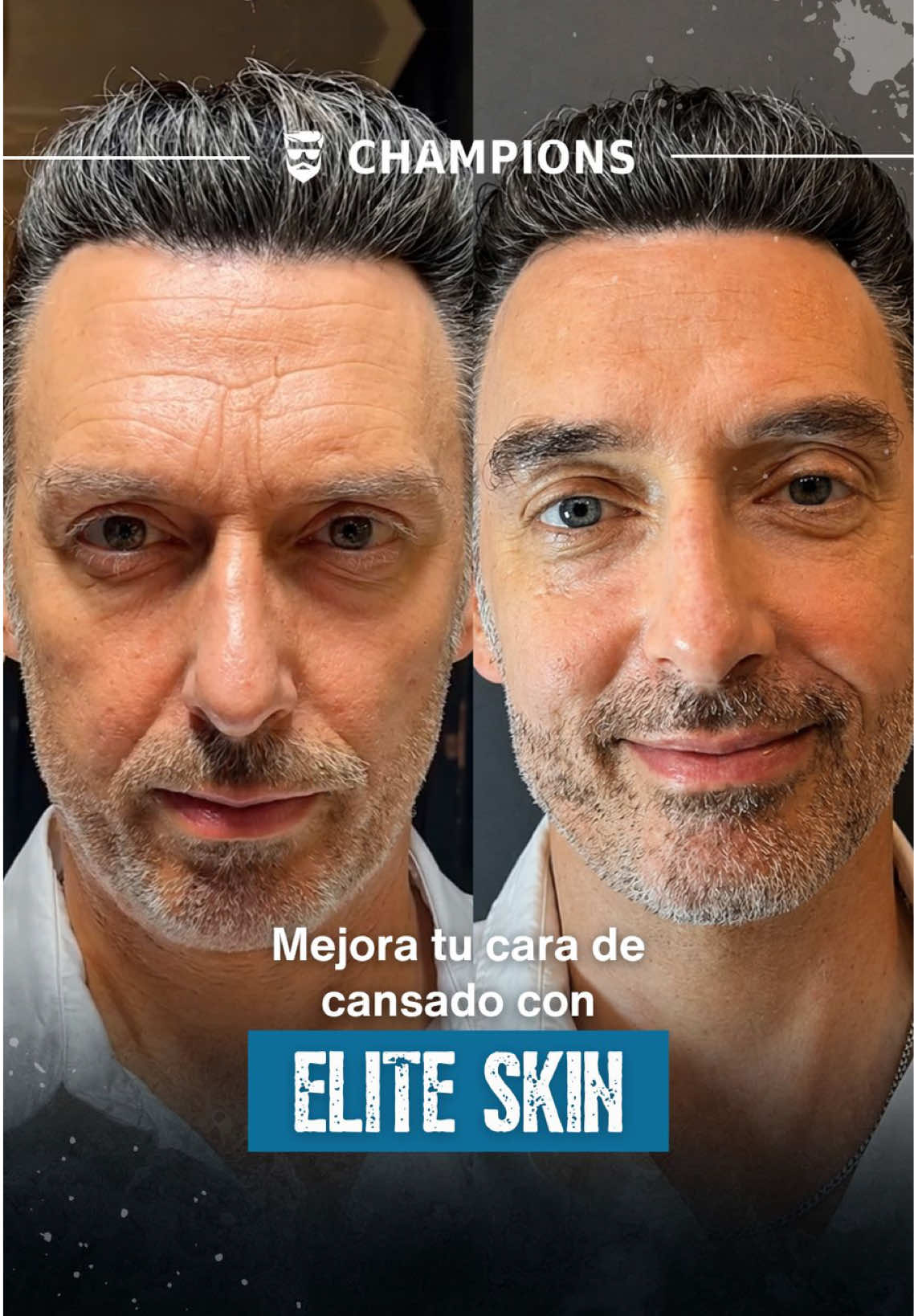 @Champions.men