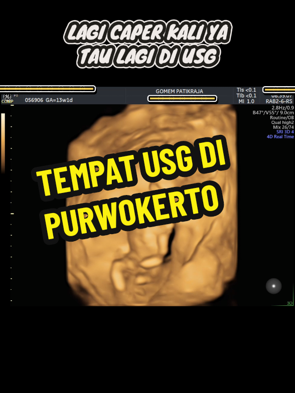 @USG 4D PURWOKERTO