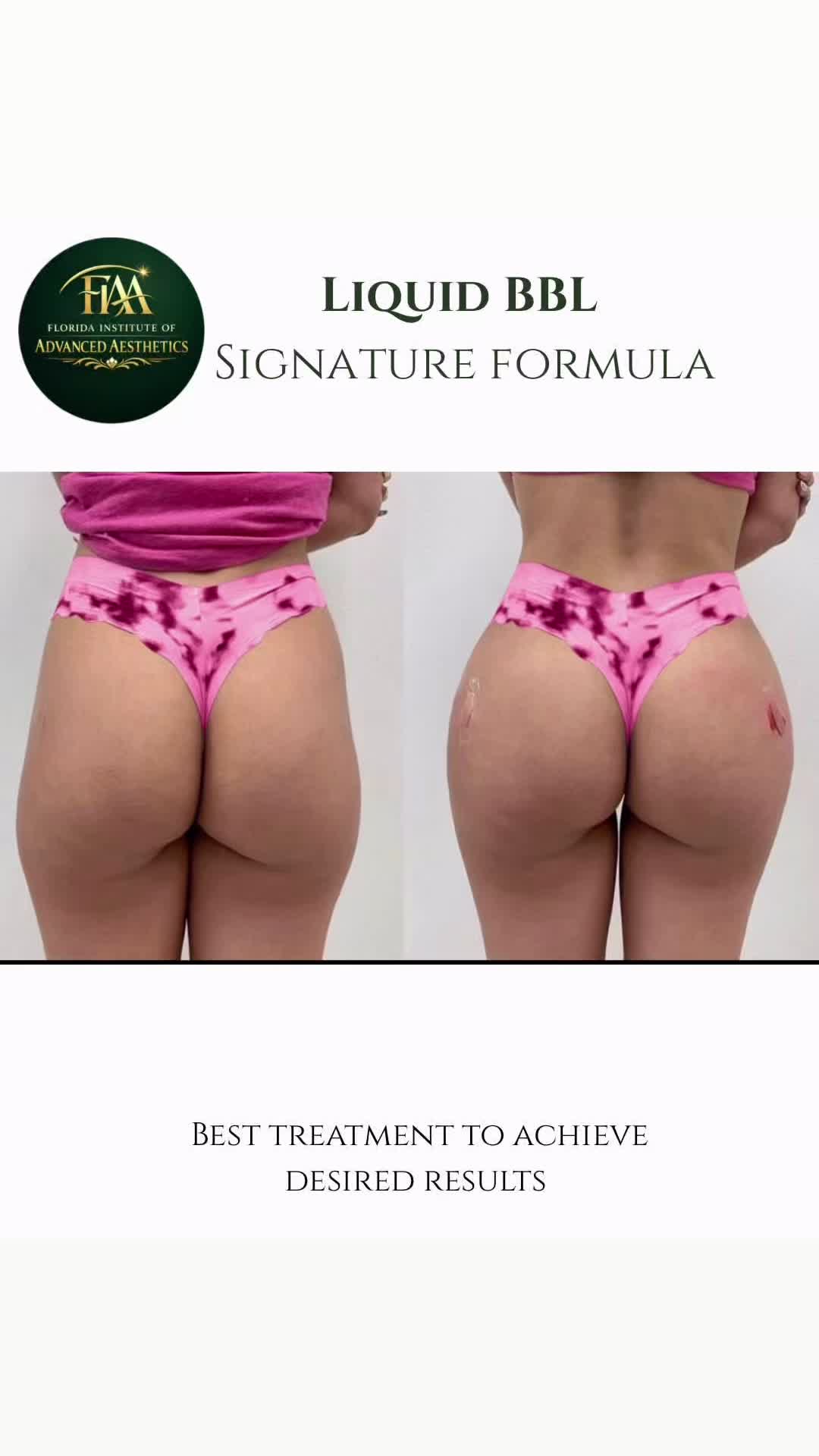 @FIAA | Advanced Aesthetics