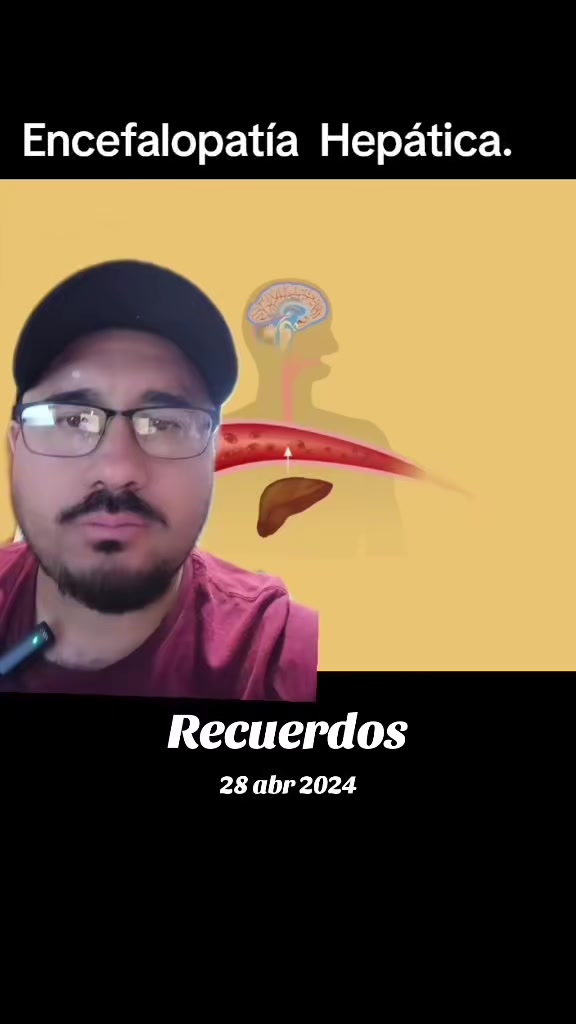 @Dr. Ajolote.