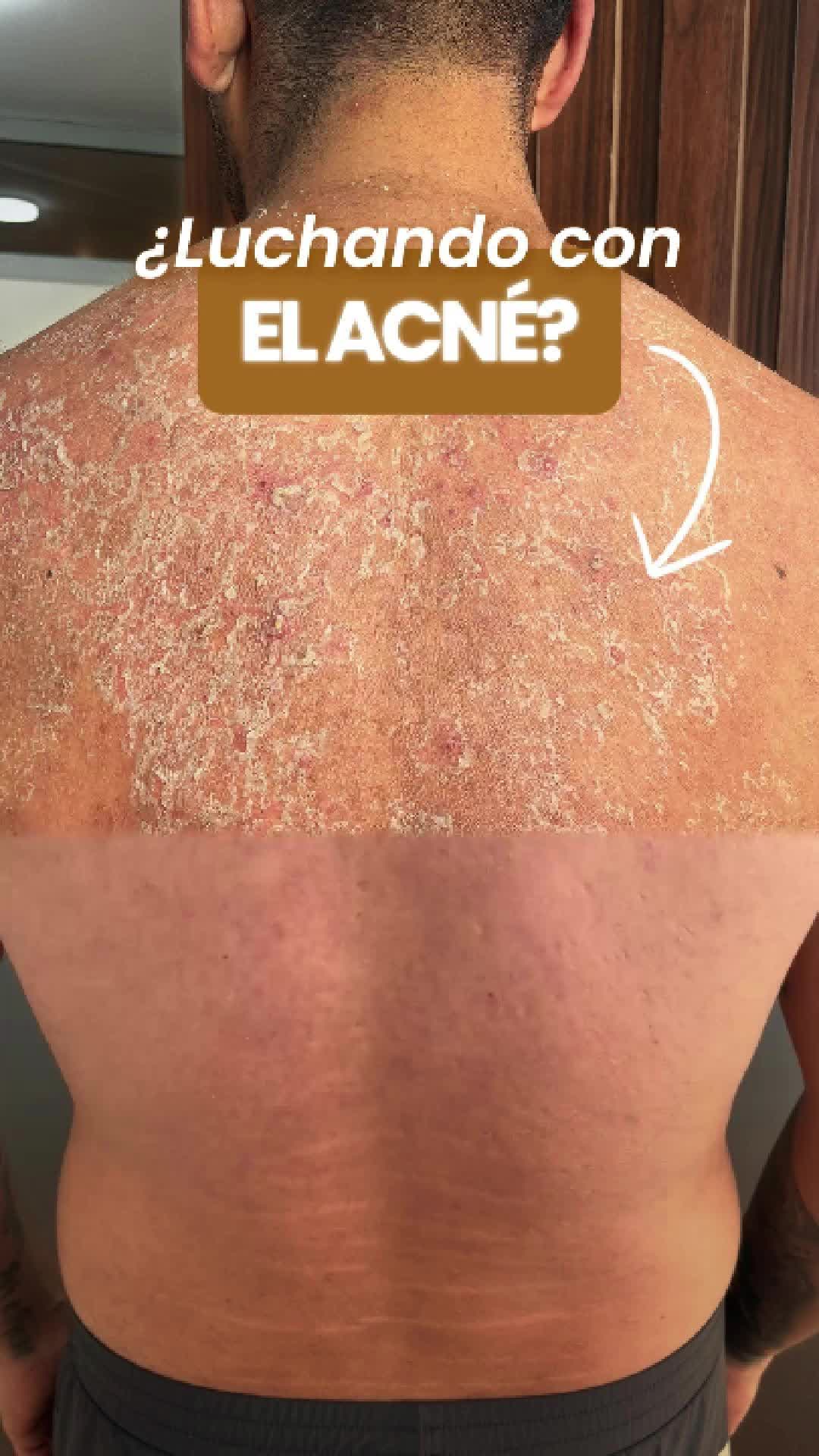 @RebellSpa