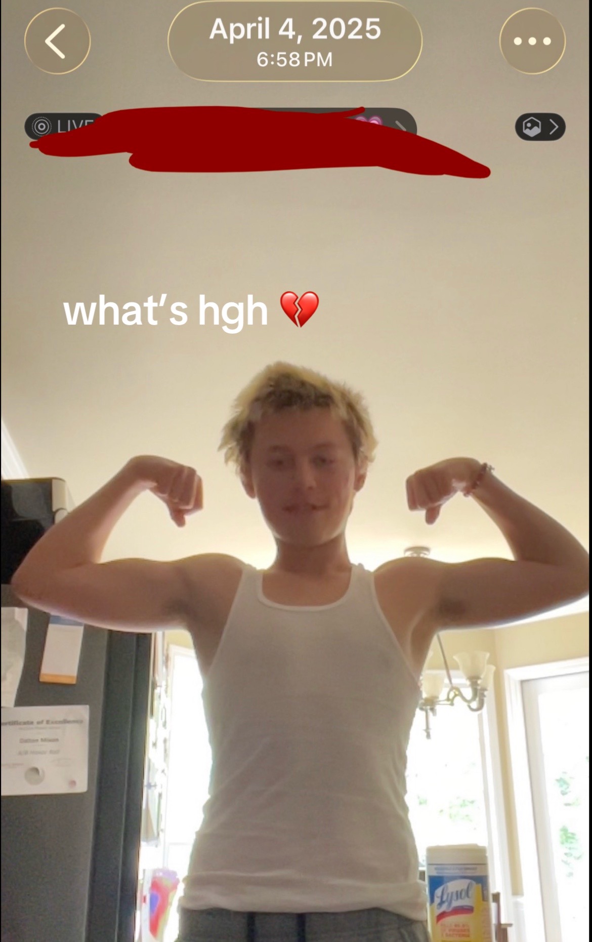 @Daltonliftss