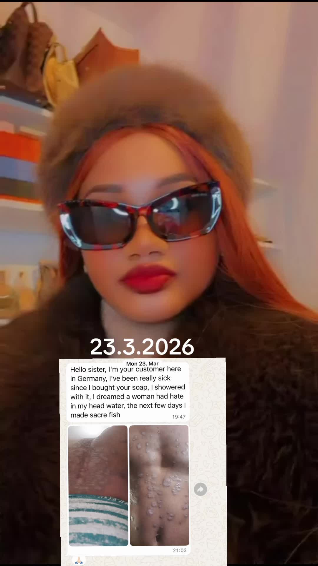 @Aichoux🇬🇳🇬🇭🇩🇪