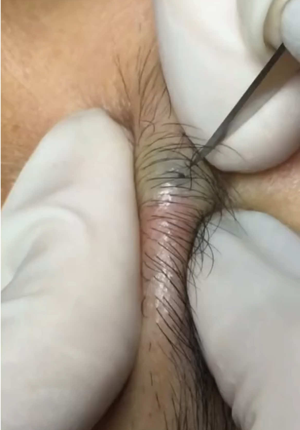@dr.euroderma