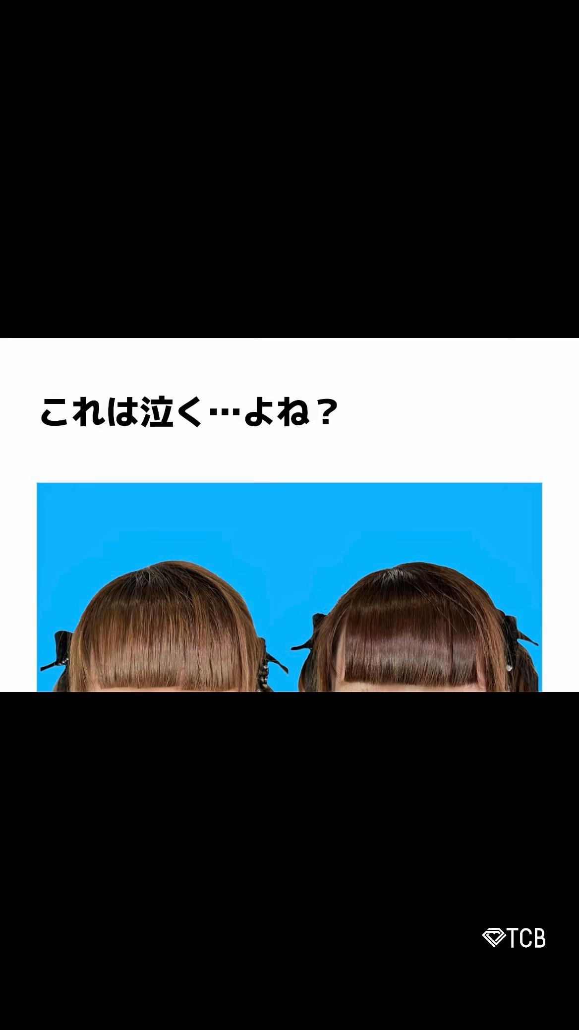 @【二重整形】TCB 新宿東口院ゆいこ先生/東京