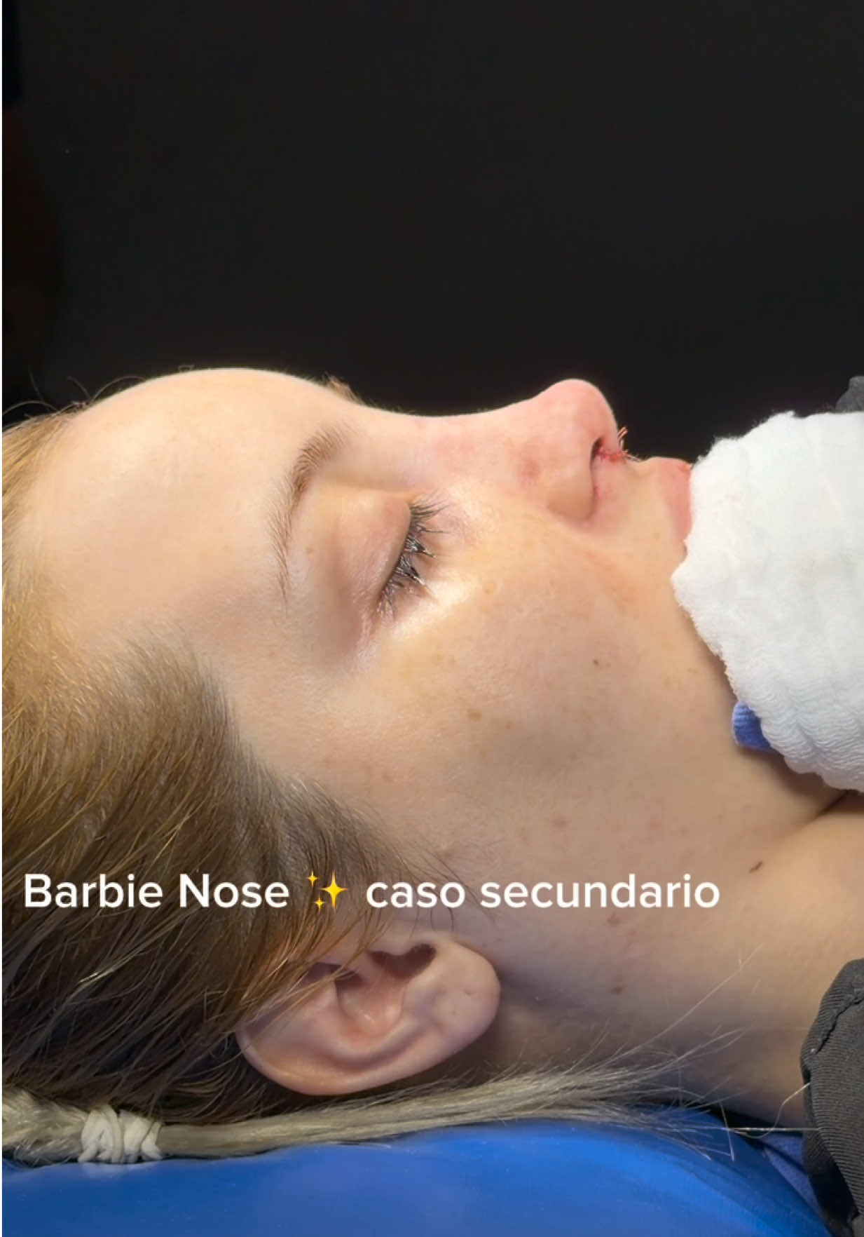 @drgarone.rinoplastia