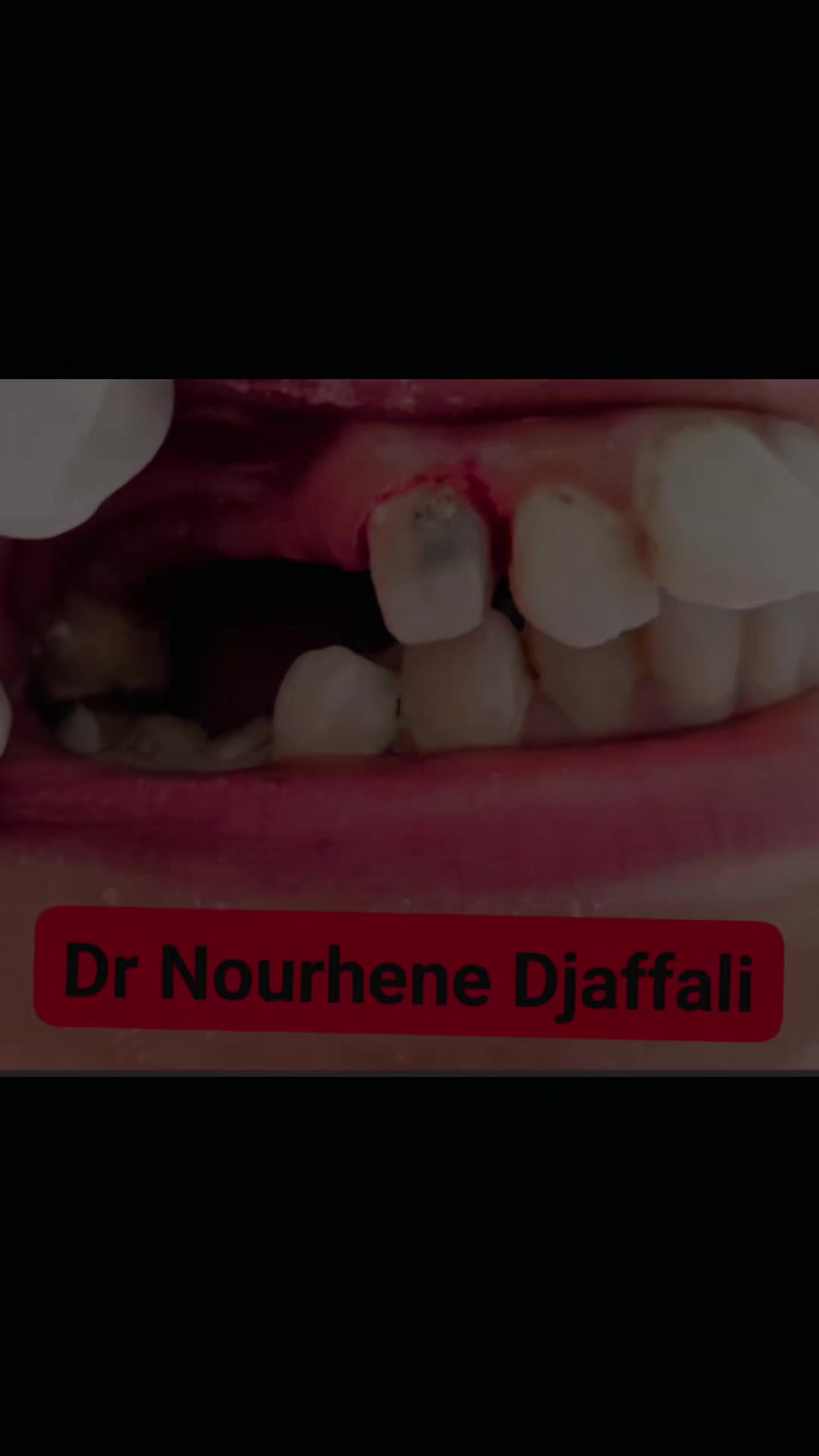 @Dr Nourhene Djaffali