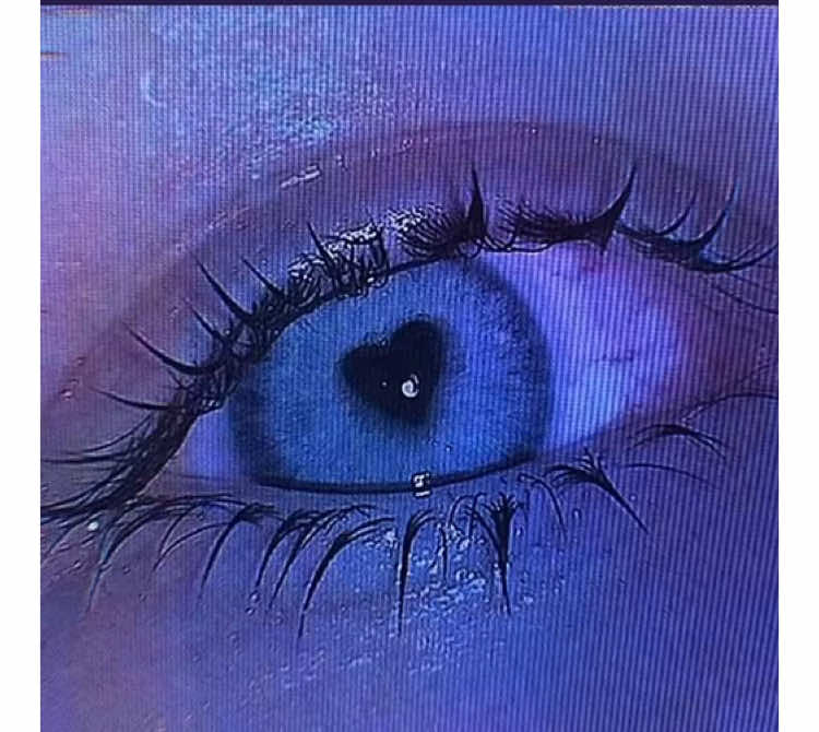 @𝔏𝔲𝔠𝔦𝔣𝔢𝔯