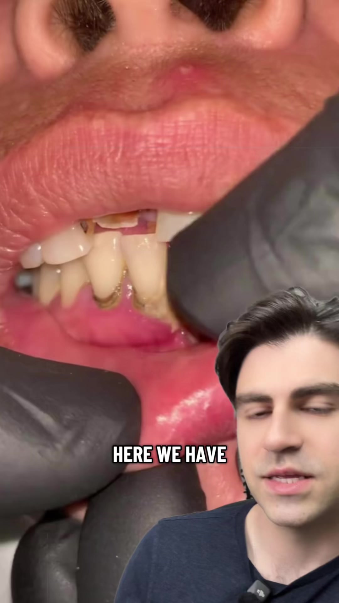 @Dr. Kadish