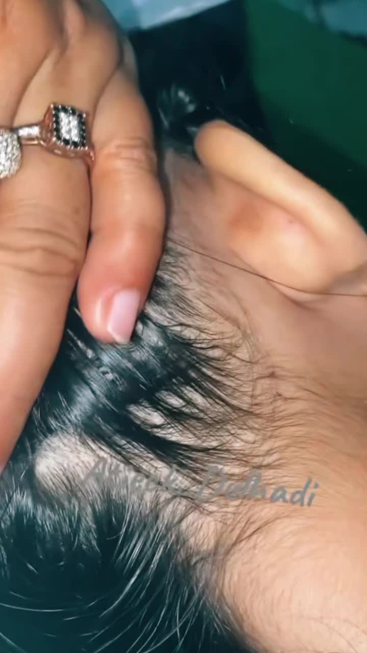 @Atieck dulhadi 🪲💇