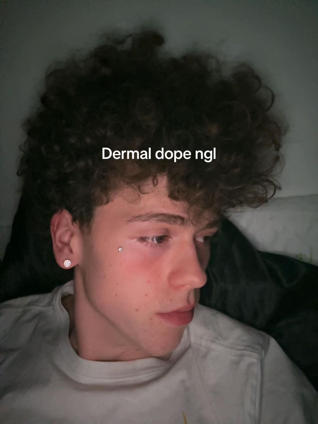 @chris