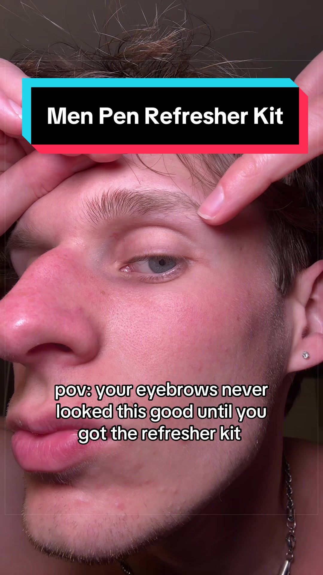 @JACOB MISSAL