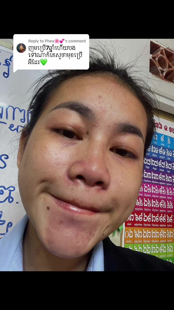 @សម្រស់ ធារ៉ា