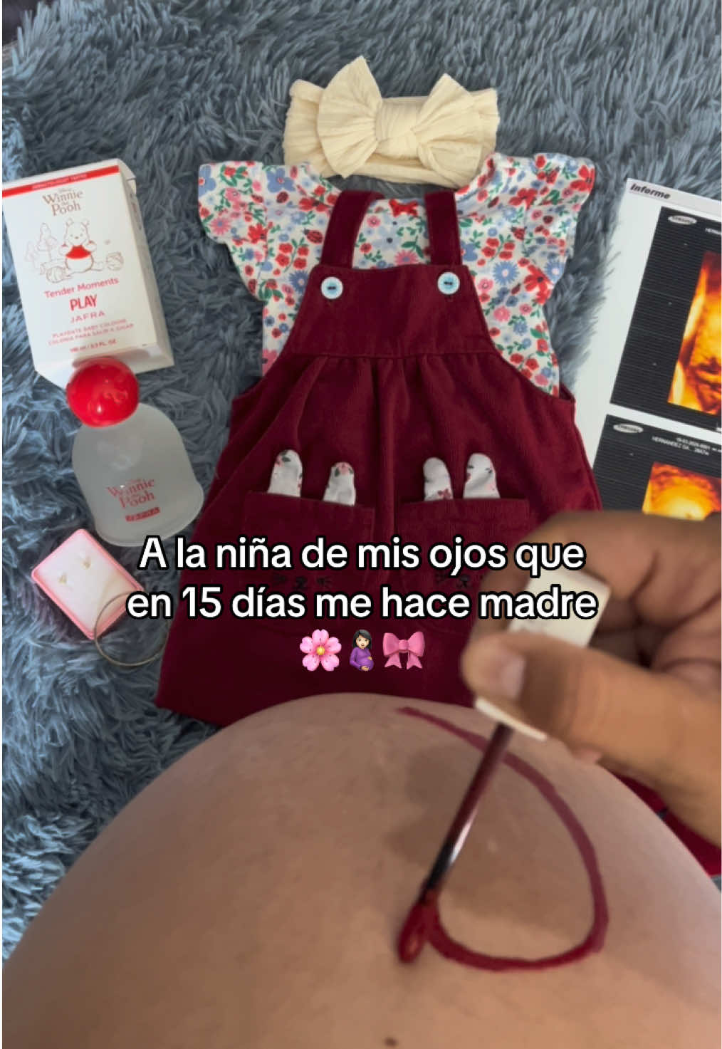 @Nayeli Hern&aacute;ndez 🎀