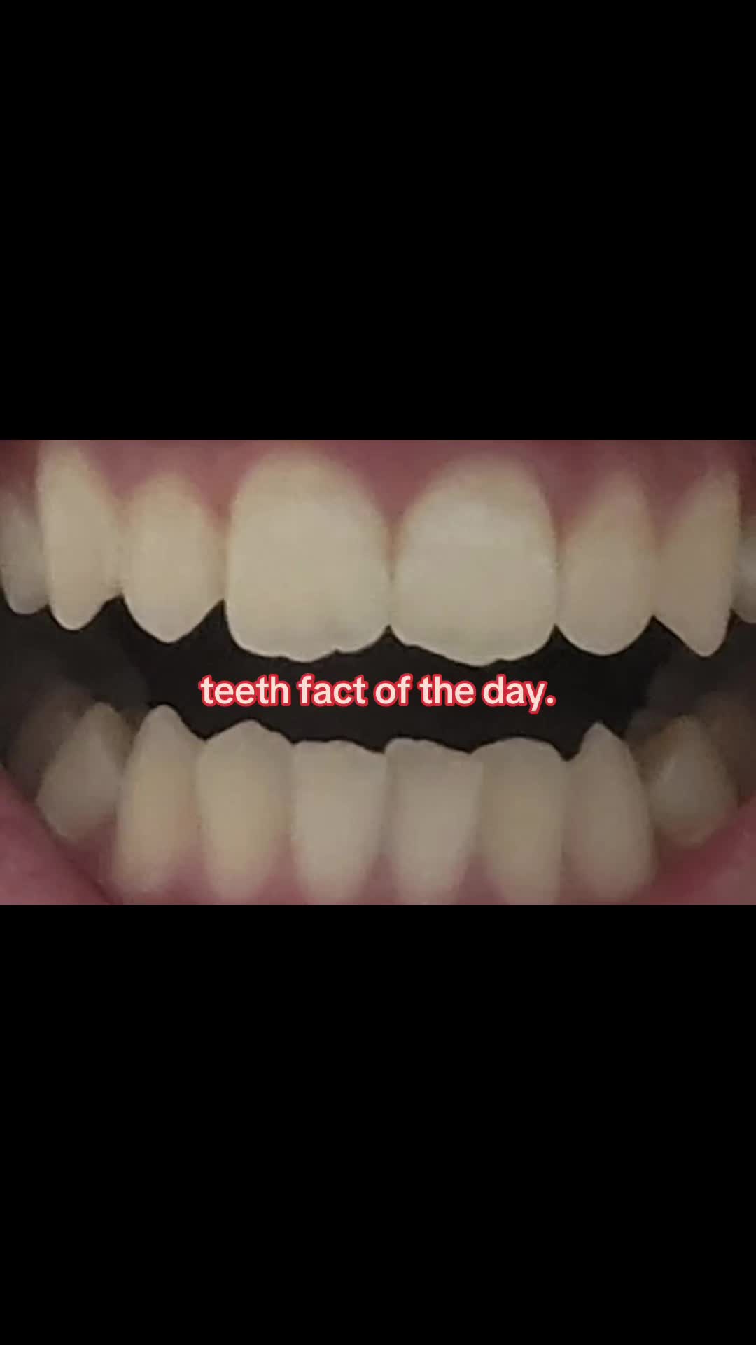 @I leik teeth moer thna mysefl.