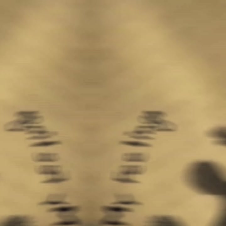 @R&oslash;dr&igrave;g&ucirc;&eacute;&szlig; &Atilde;&ntilde;&iacute;l