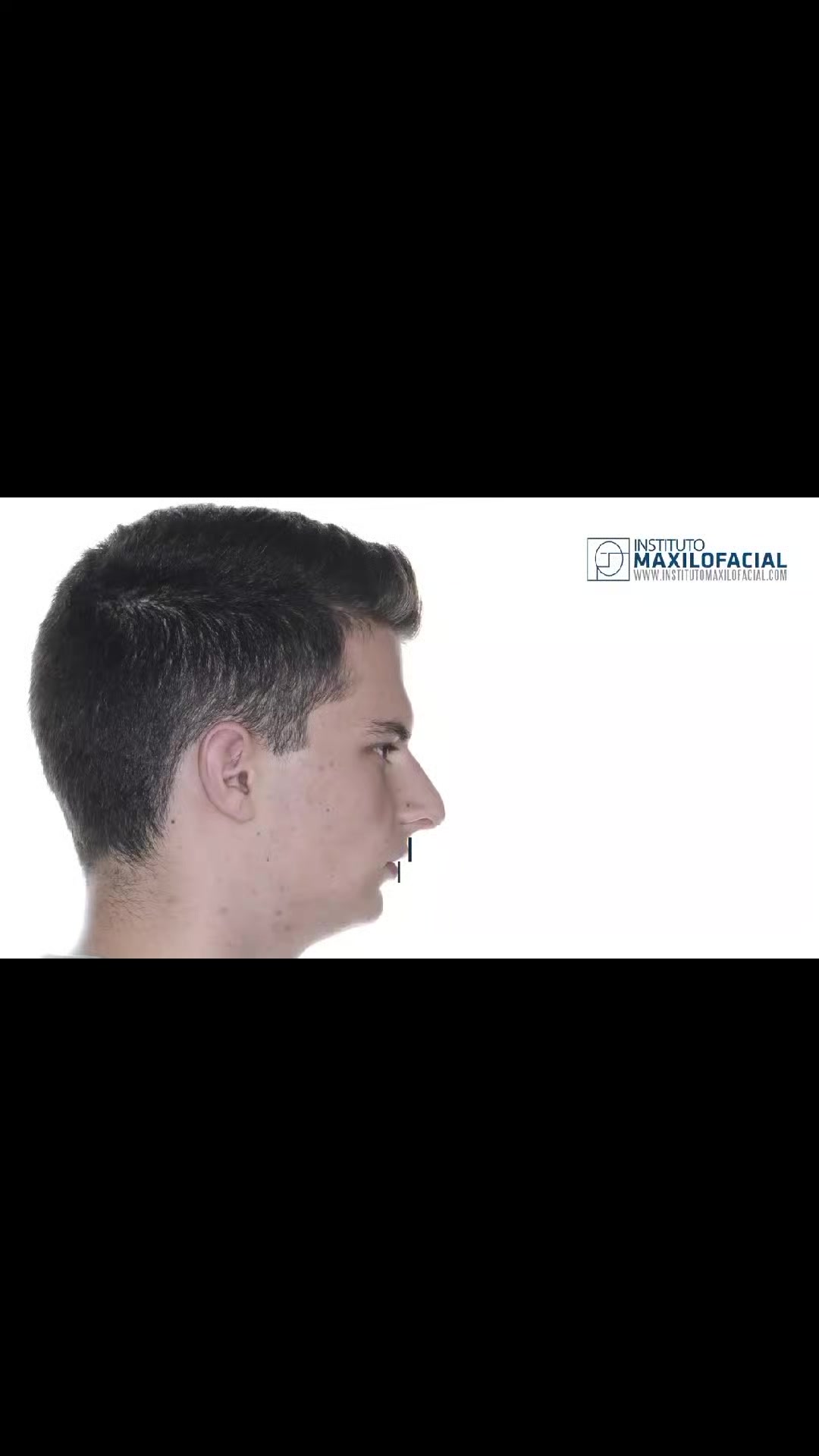 @basedepart