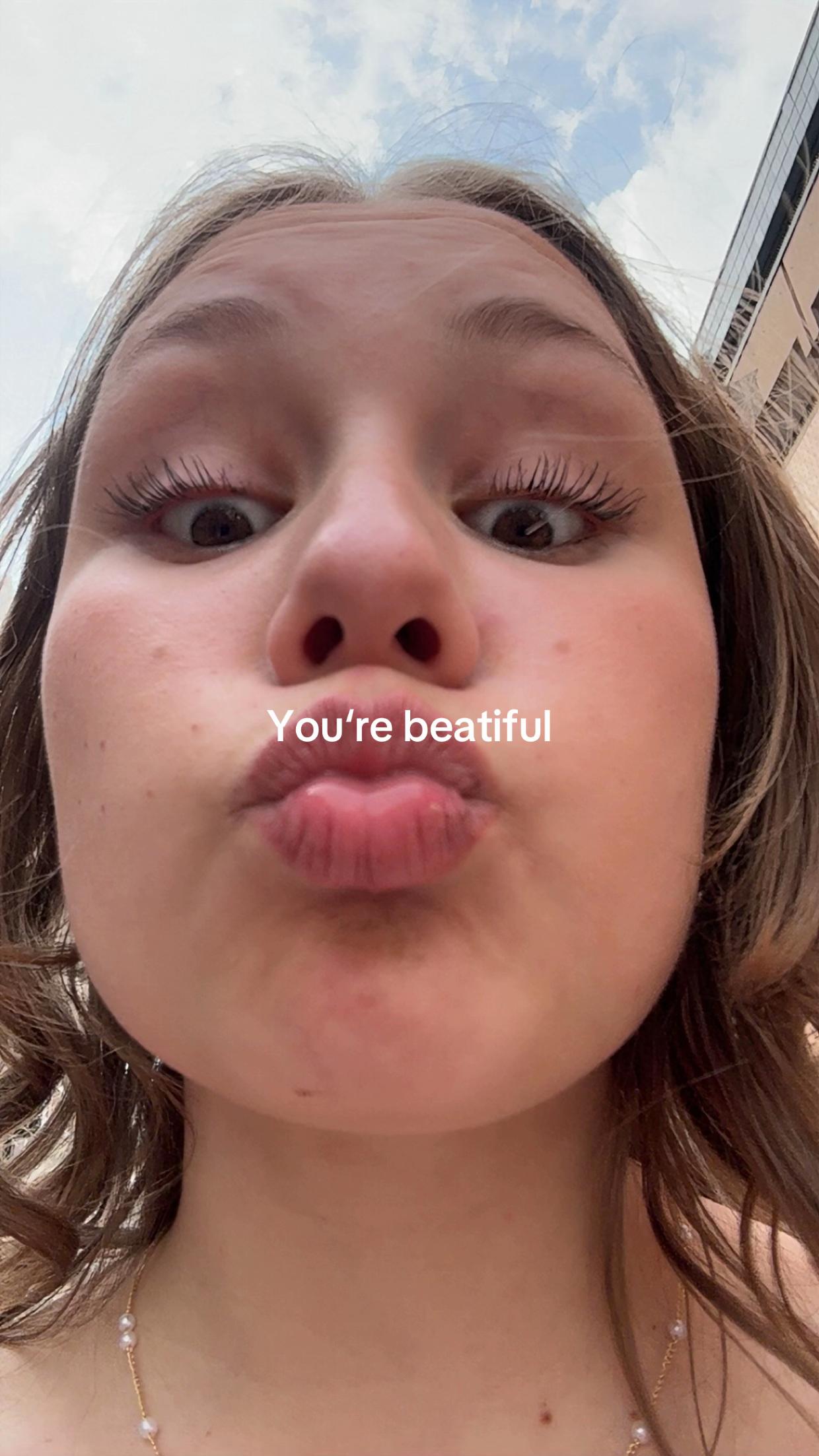 @Caro