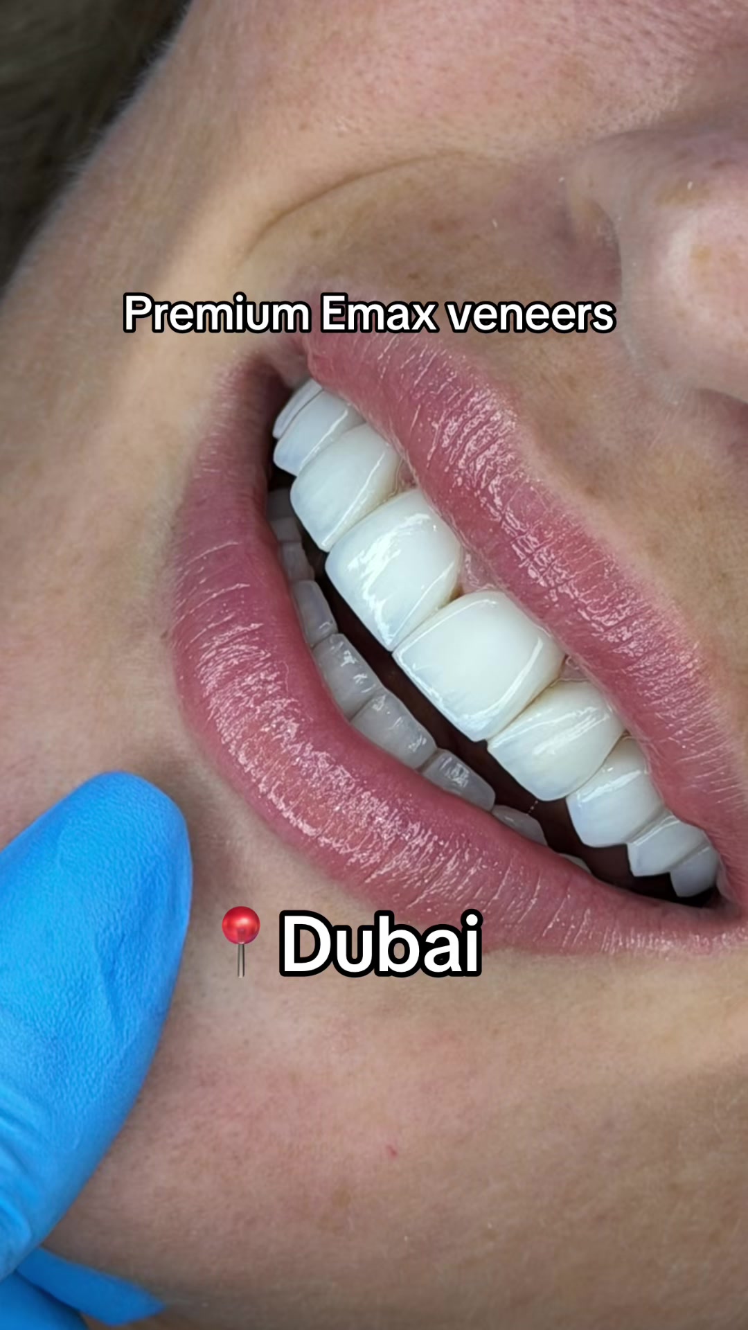 @Dr.Negin