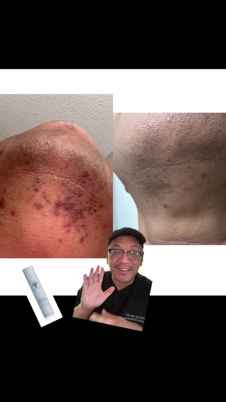 @EstheticianPete