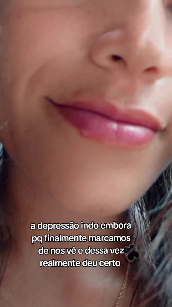 @Fran