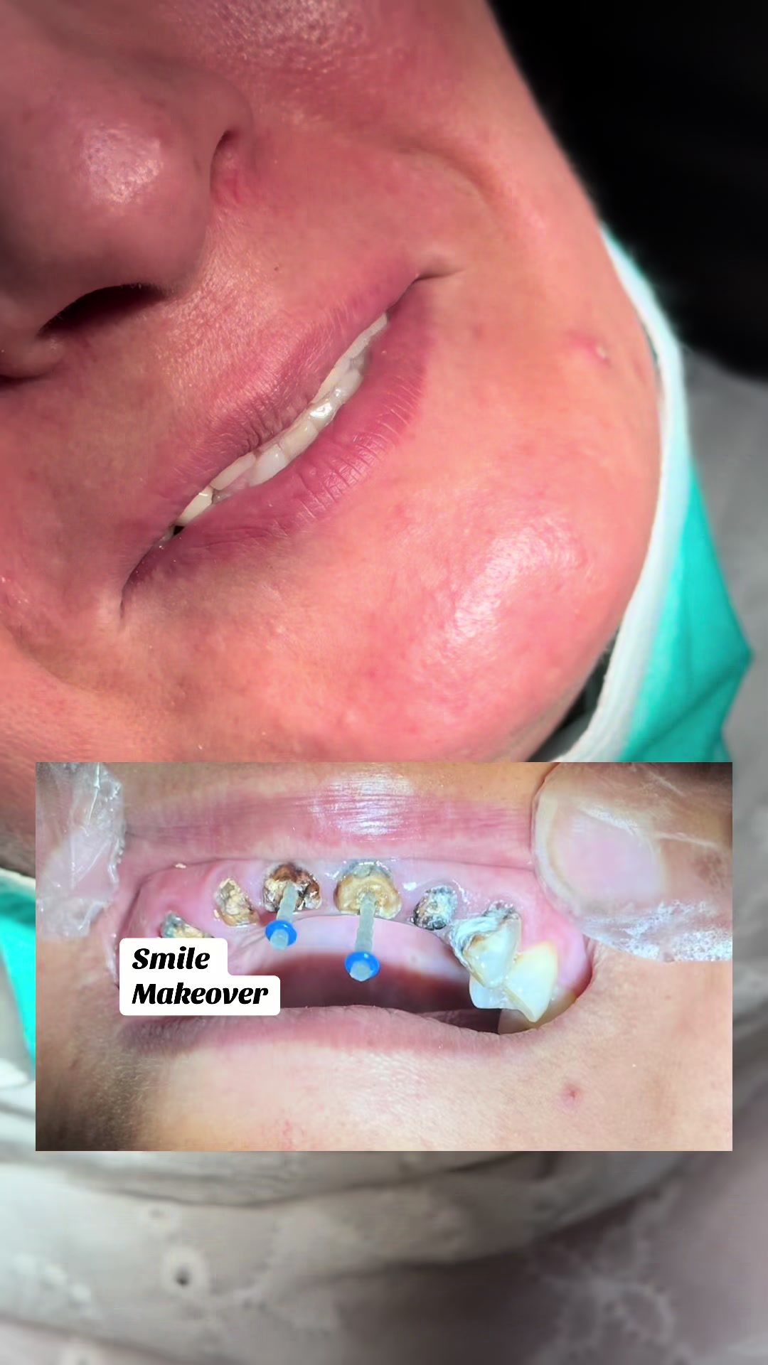@Dr Hammad| Dental Surgeon