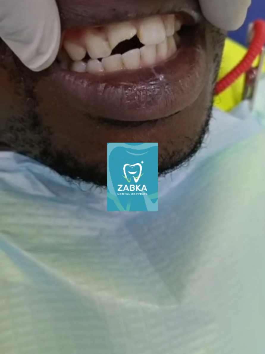 @Zabka Dental
