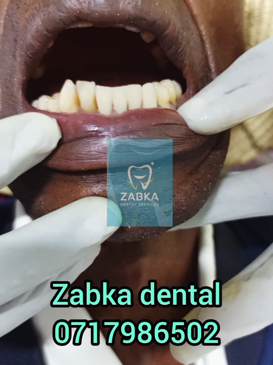 @Zabka Dental