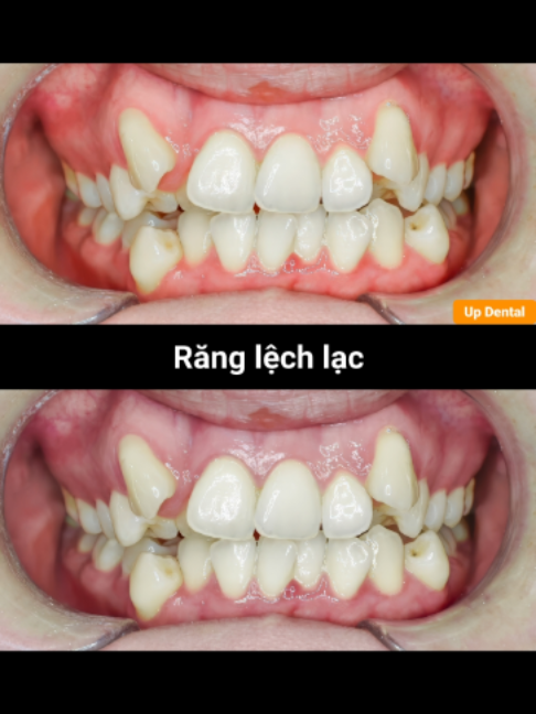 @Nha khoa niềng răng Up Dental