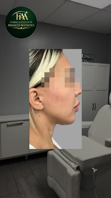 @FIAA | Advanced Aesthetics