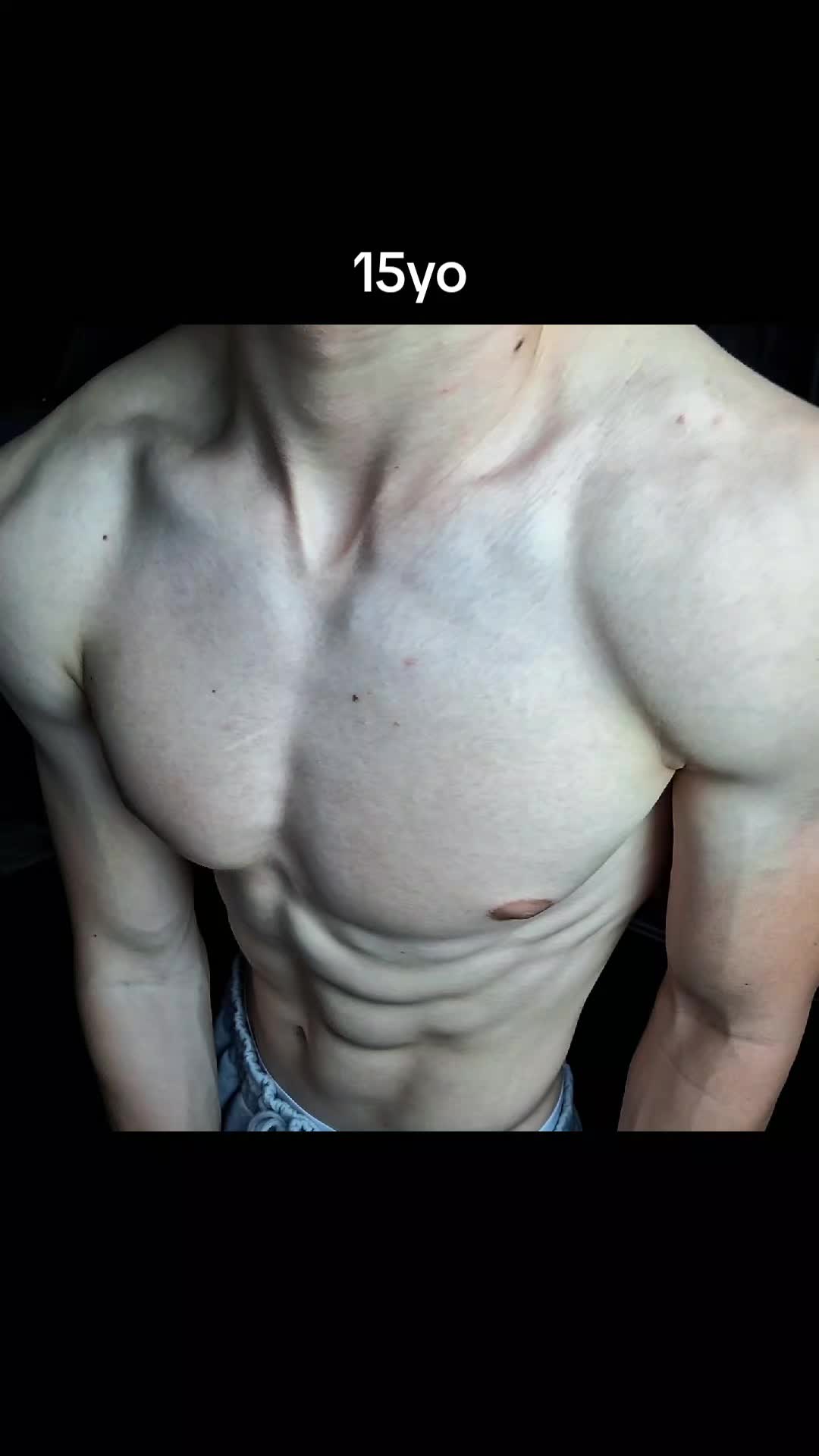 @Boraesthetics
