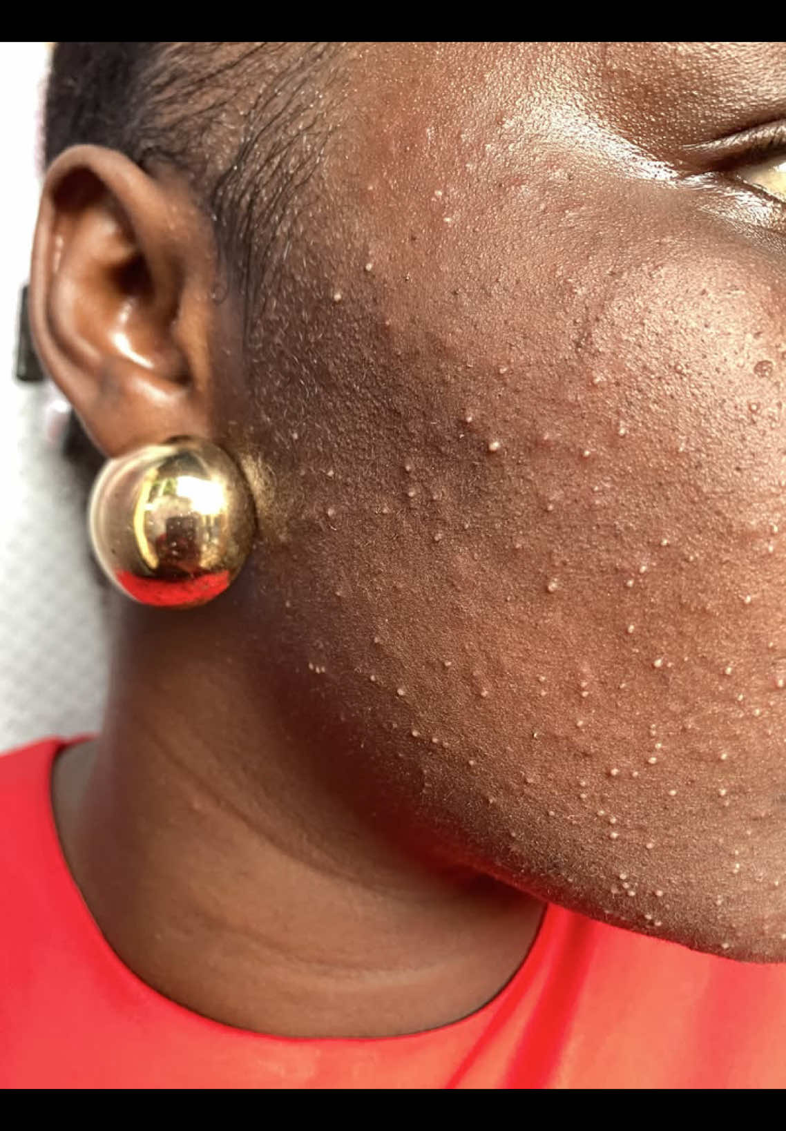 @SKINCARE IN LAGOS 🇳🇬