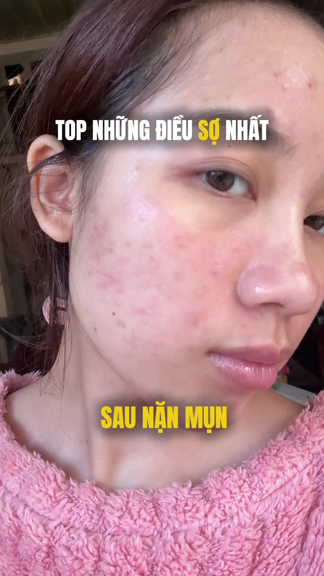 @chưa mối t&igrave;nh đầu