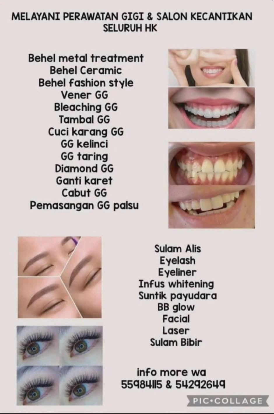 @Ubi ungu
