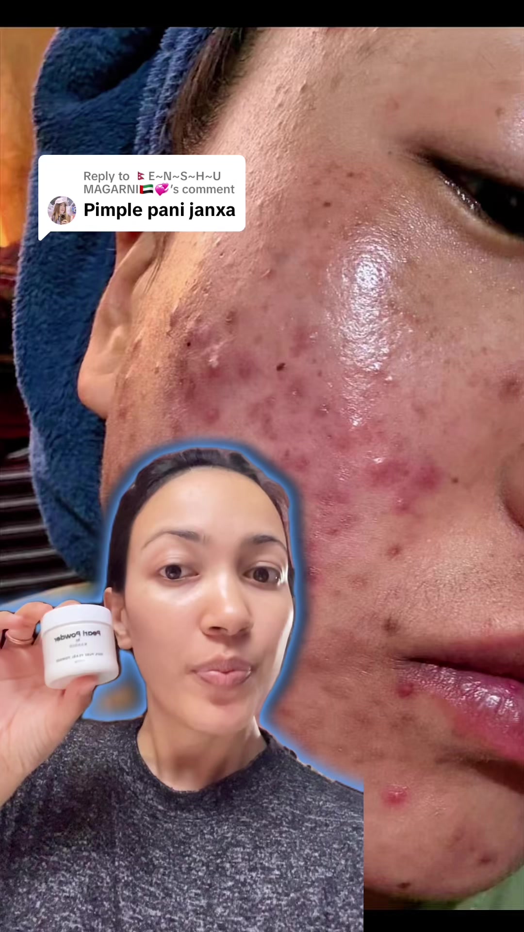 @Minimagic Skincare🇳🇵