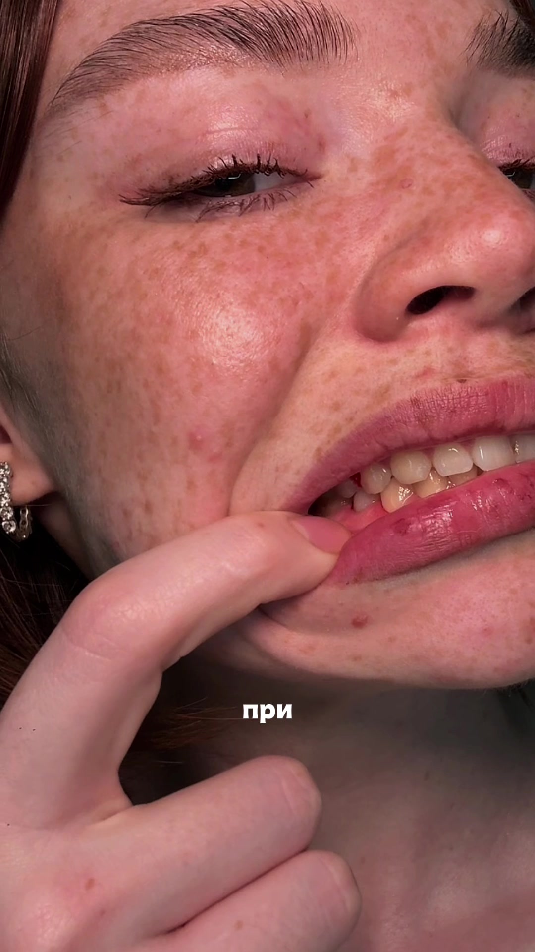 @Стоматологиня