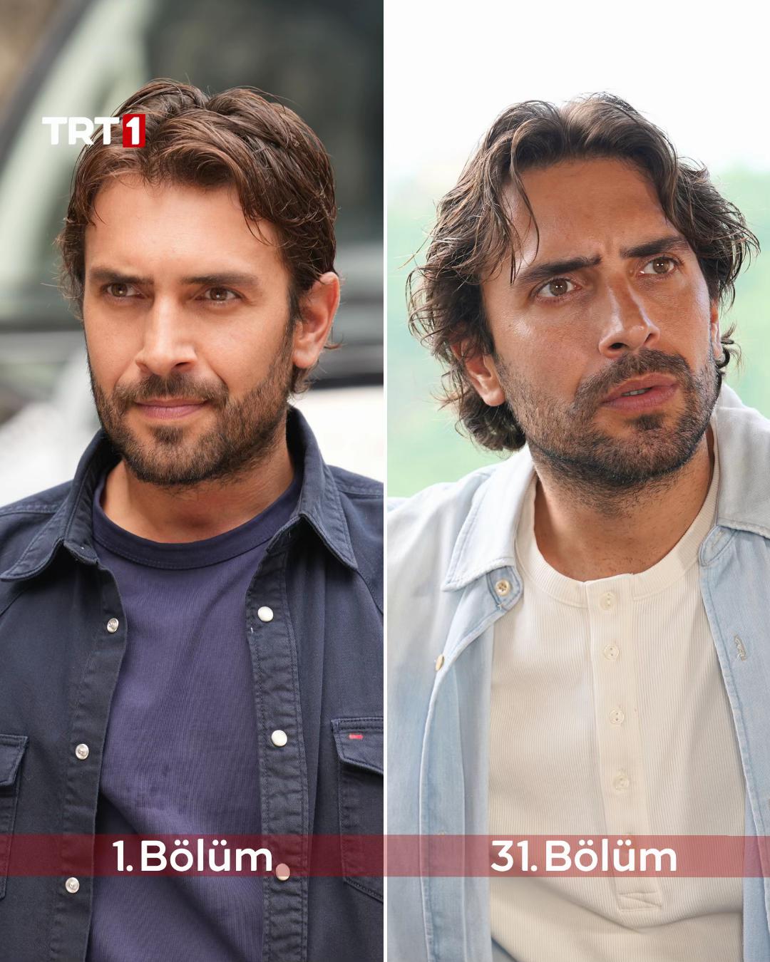 @TRT 1