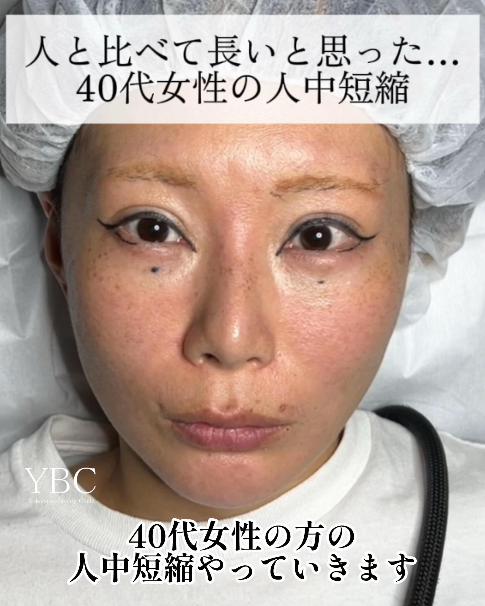 @イソセン/美容外科医（磯村亮輔院長）
