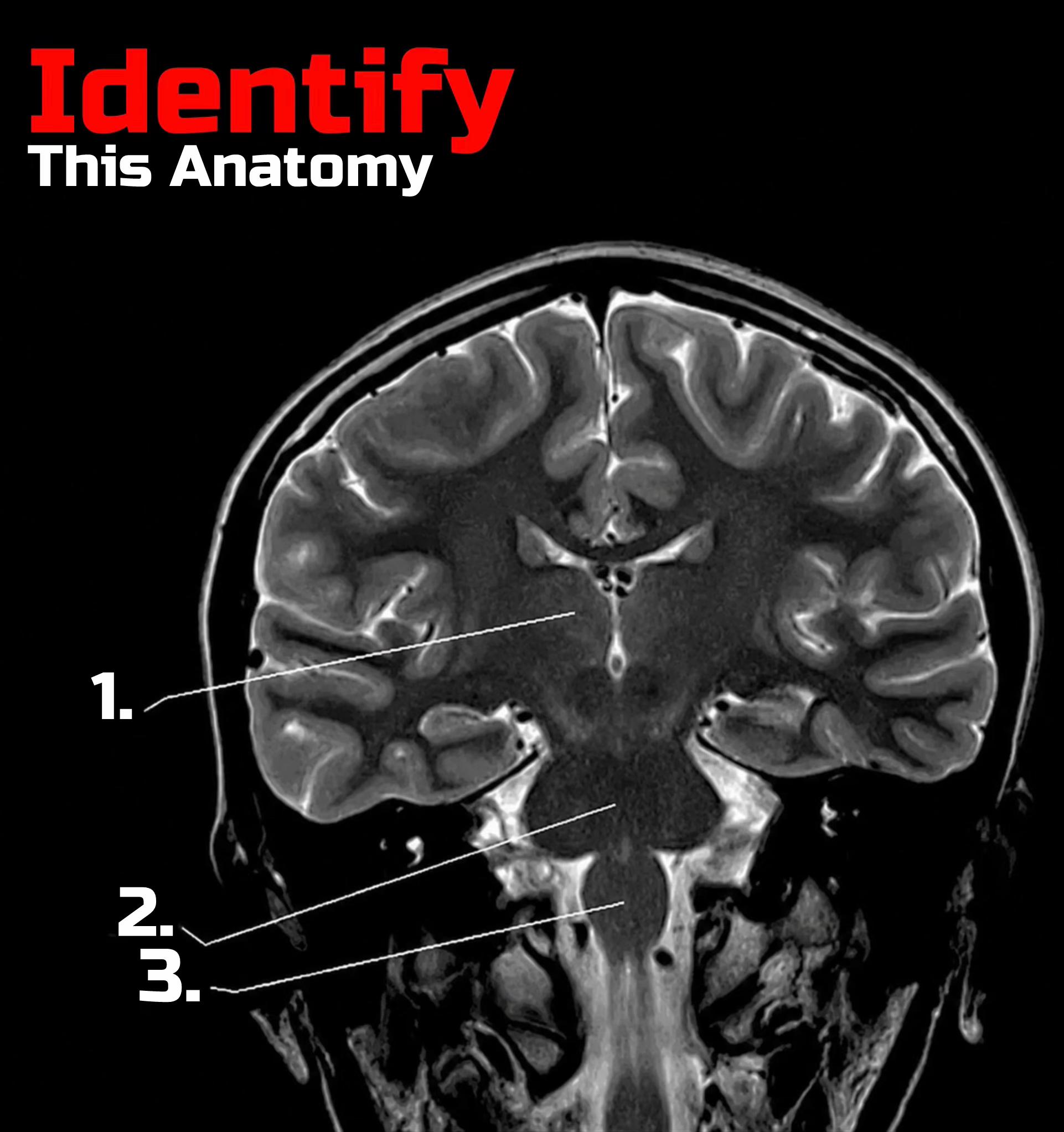@Sobat Radiology