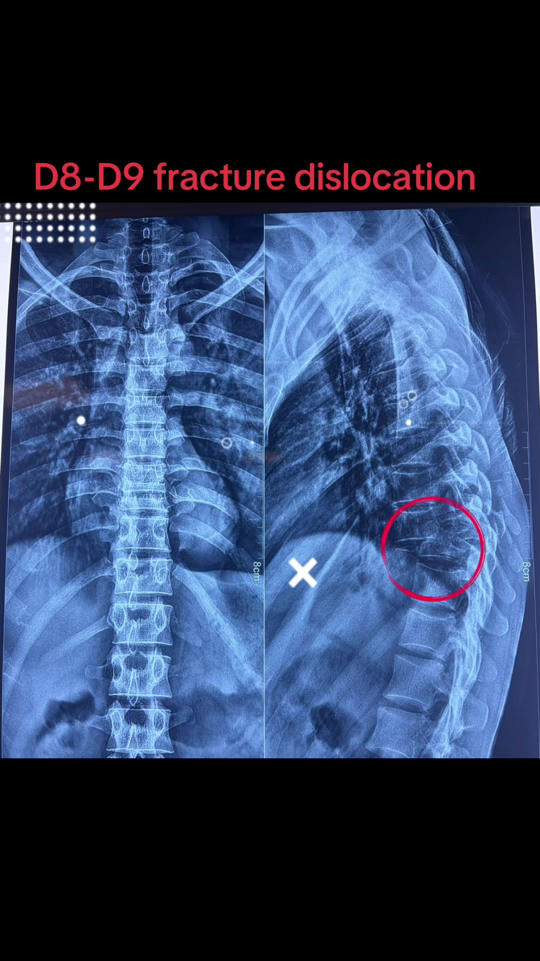 @Spine_Ortho_Surgeon_Arbind