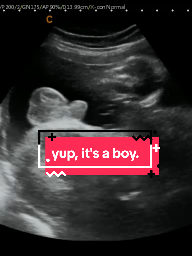 @Hey, Baby!