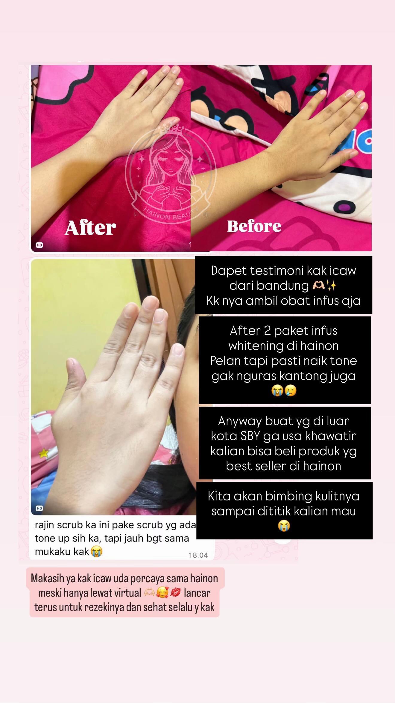 @Hainon Infus Whitening
