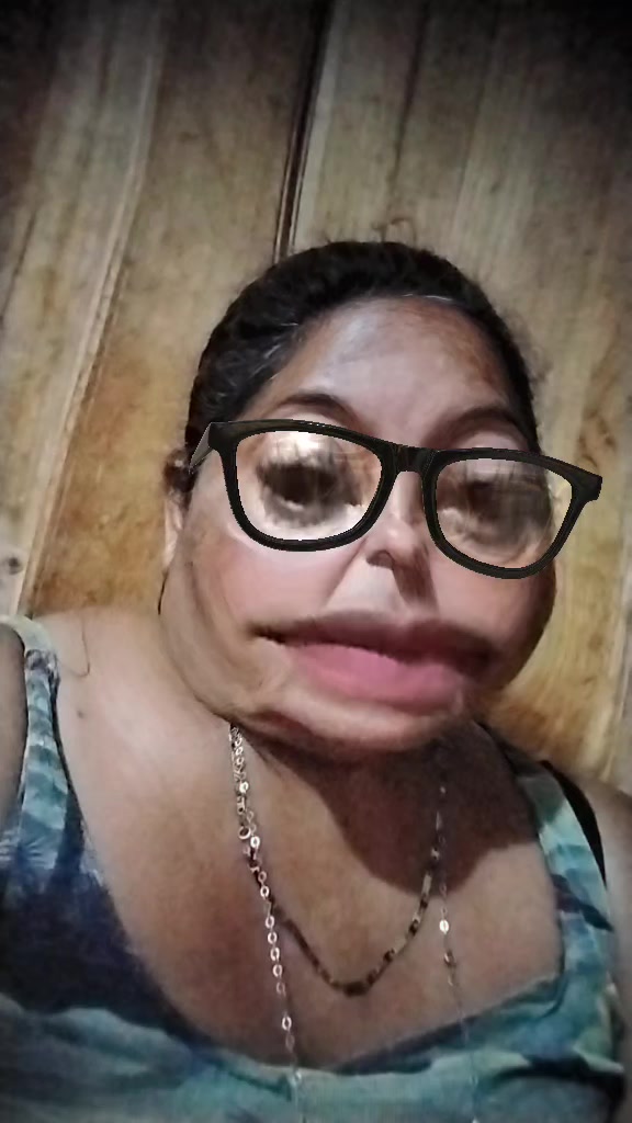 @Noe