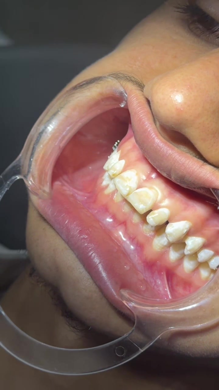 @Dr__Anmoll🦋🦷