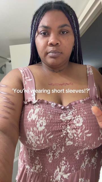 @I.brenanii
