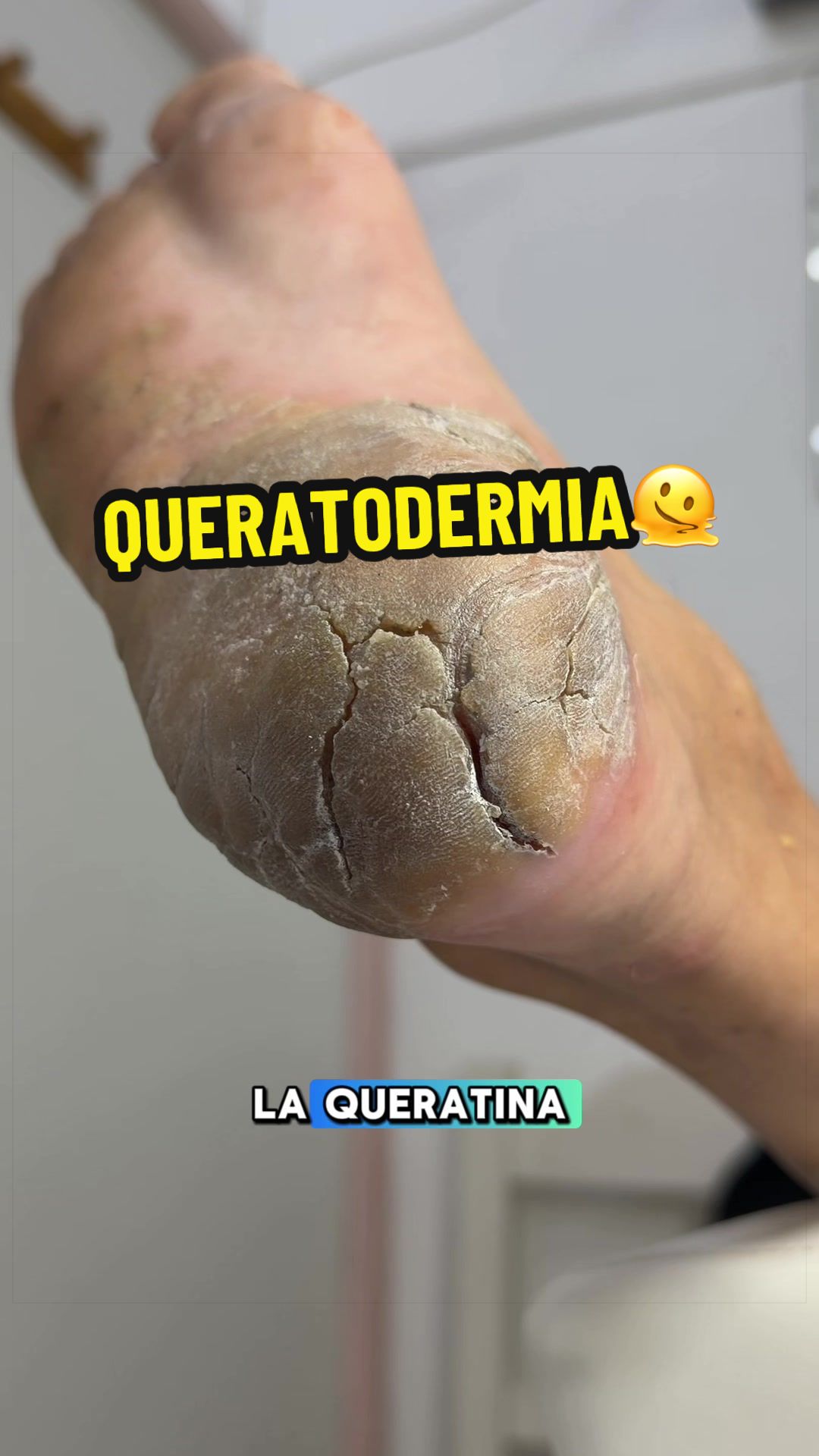 @podología calzada