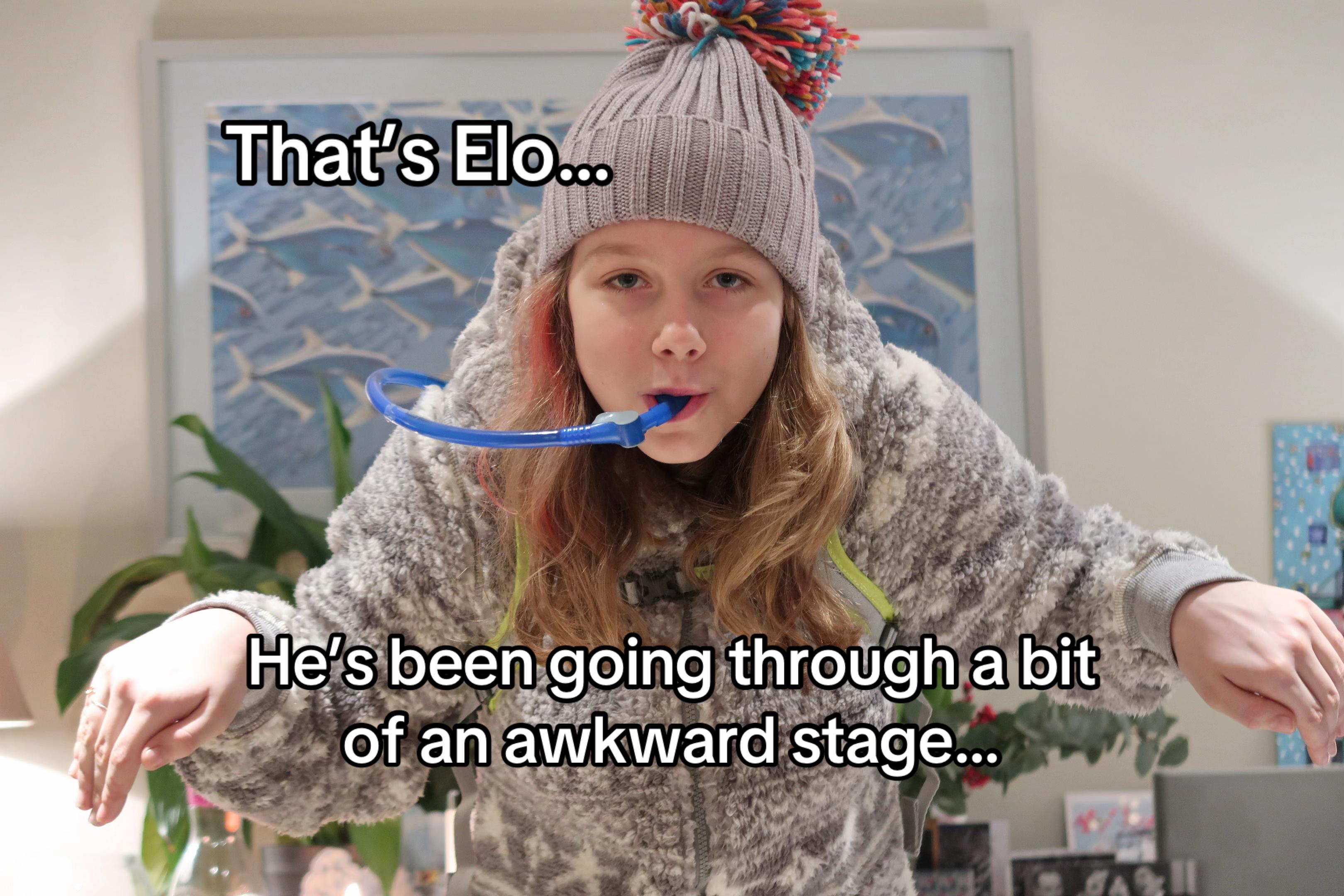@Elo /๐๐ผ/๐๐/๐๐ด/๐๐/๐ชฒ